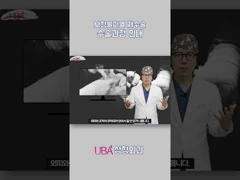 가슴보형물파열 수술의 과정은? 절개법, 보형물제거, 피막제거! #가슴보형물파열