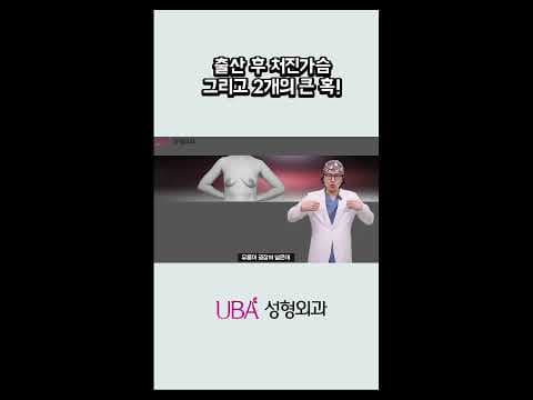 출산 후 처진가슴 보형물만으로 UU라인 가능한 경우! #처진가슴 #UU라인