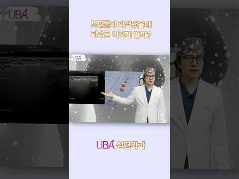 가슴보형물파열시 피막을 완전히 제거해야 하는 이유! #가슴보형물파열 #피막제거